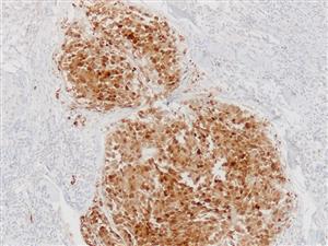 3740B | Control Slides:Immunopathology; S-100